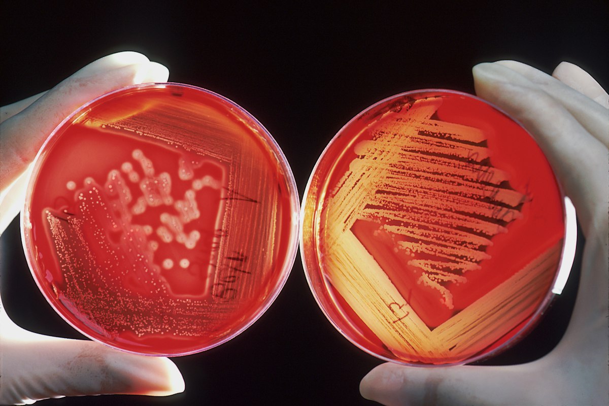 Microbes are becoming resistant to antibiotics