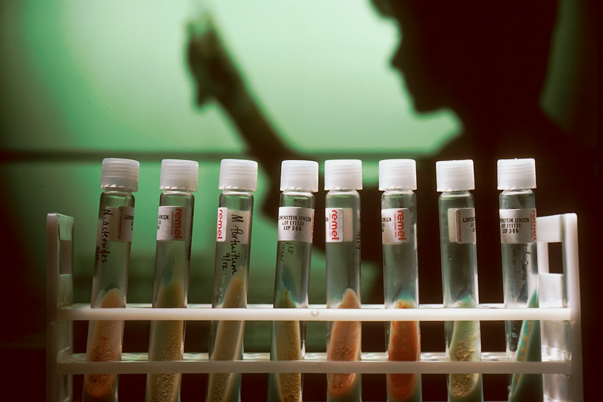 Three things to keep in mind when taking antibiotics