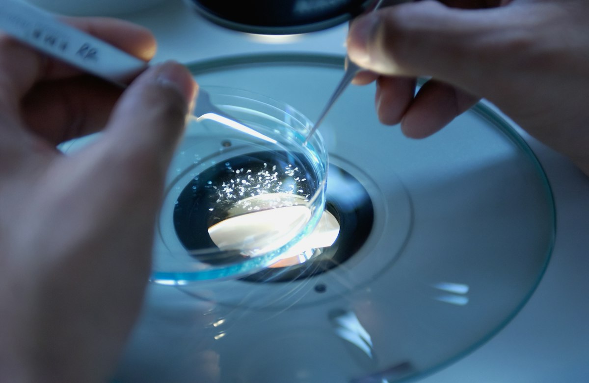 Hands using tweezers to manipulate small white particles in a glass petri dish